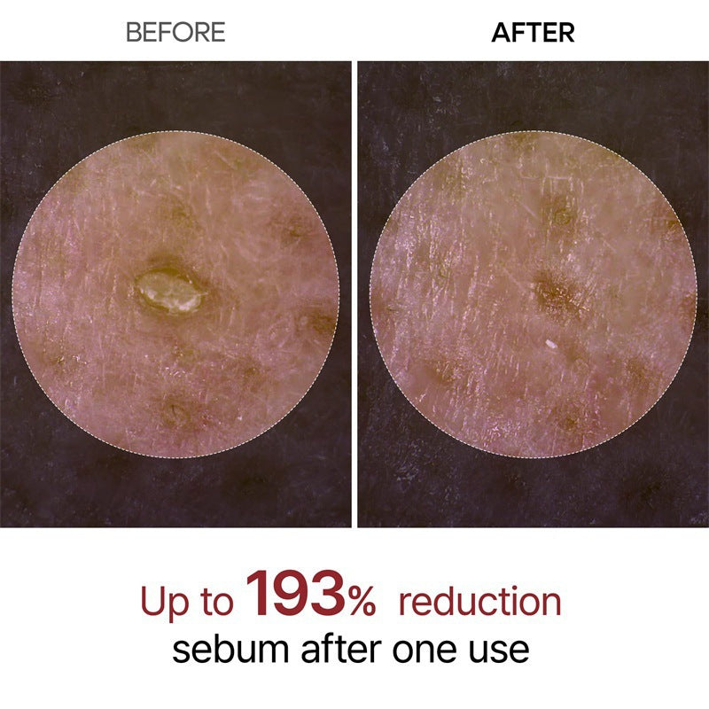 Lalamon™ Rice Peeling Ampoule