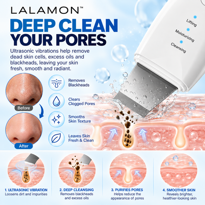 Lalamon™ Ultrasonic Skin Scrubber
